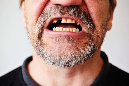 sognare di perdere i denti persona senza dente
