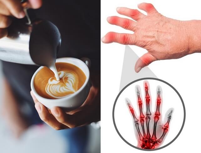 caffè e artrosi
